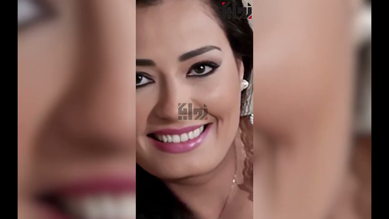 “عاجل” إصابة إنجي عبدالله ملكة جمال مصر بالسرطان