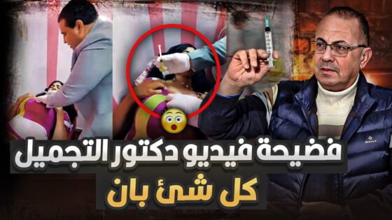 فيديو دكتور التجميل أحمد النعماني المزيف