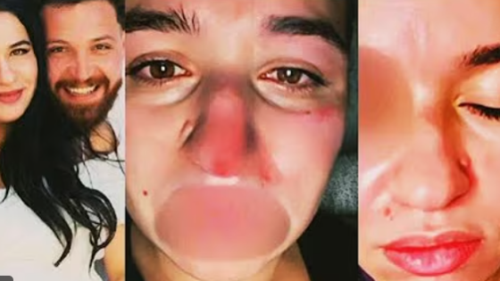 فيديو فضيحة محمود حجازي في الفندق